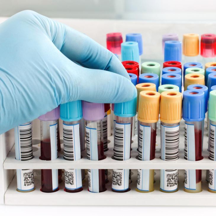 ที่ขายดีที่สุดโรงพยาบาลเวชภัณฑ์ Vacutainer ทิ้งหลอดดูดเลือดเก็บเลือดด้วยสารเต...